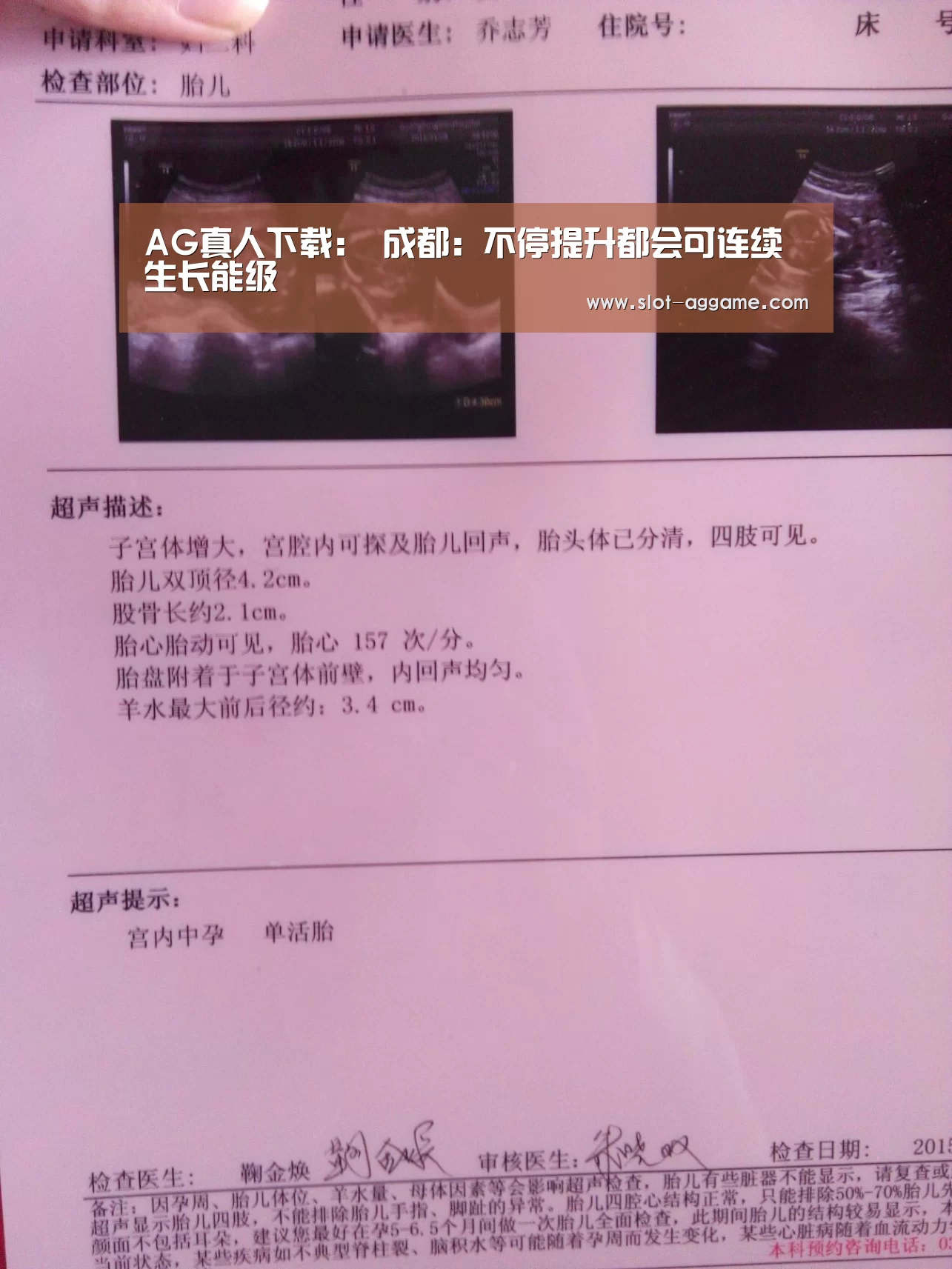 ag真人注册